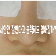 세안만 잘한다고 블랙헤드 없어질까?