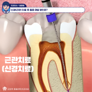 신경치료 후 통증 재발 원인은? 교대역 근관치료 후 감염 증상