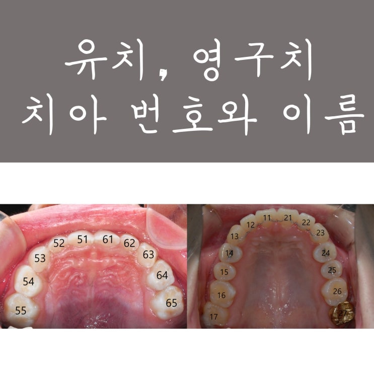 유치 영구치 치아 번호와 치아 이름 : 네이버 블로그