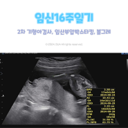 임신 16주 - 2차 기형아검사, 임산부 압박스타킹, 철분제 처방