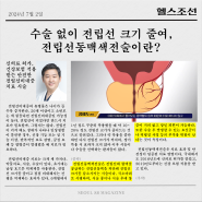 [헬스조선] 수술없이 전립선 크기줄이는 전립선동맥색전술ㅣ전립선비대증병원 서울88의원