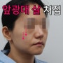 앞광대 살 처쳤지만 미니거상 유지기간 아쉽다면