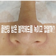 클렌징 밤은 블랙헤드를 녹이고 없앨까?