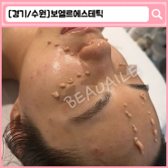 [경기/수원시] 수원 인계동 피부관리 '보엘르에스테틱'