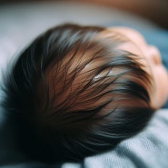 신생아 머리딱지 아기 두피 노란딱지 원인 지루성피부염 관리하는 방법은?