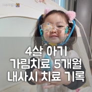 4살 아기 내사시 치료 기록 5. 가림치료 5개월 후기