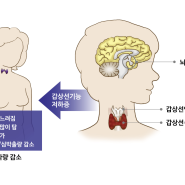 갑상선기능저하증 증상을 알아봤어요. 경험담 + 조사한 내용