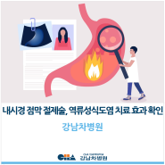 [강남차병원] 내시경 점막 절제술, 난치성 역류성식도염 치료 효과 확인