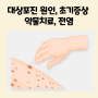 허리 대상포진초기증상 통증 병원 치료 약 전염