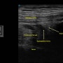 [답십리한의원] 무릎통증, Anterior Knee 초음파 검사