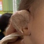 [육아 기록] 생후 80일 아기 귀 교정 - 베이비이어 1회차