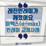 레진인레이가 깨졌어요, 이멕스(e-max)인레이 교체사례