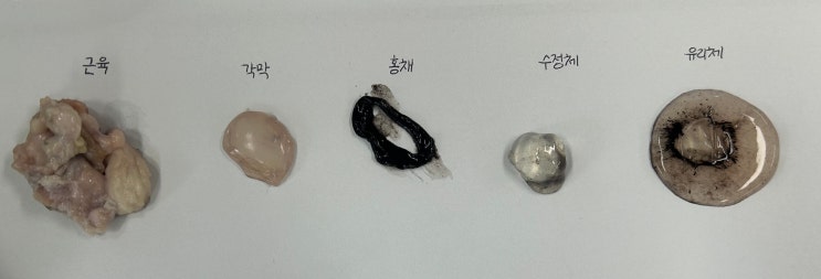 멸치 해부 & 소 눈 해부 : 네이버 블로그