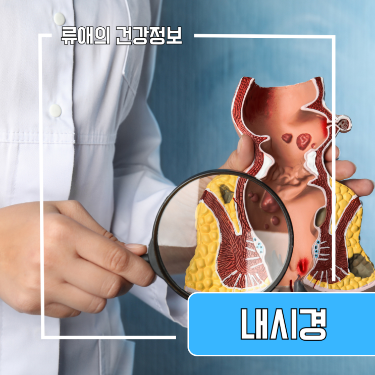 수면 대장내시경 용종제거 : 비수면 대장내시경 후 식사 및 약 복용 : 네이버 블로그