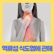 가슴통증으로 나타나는 역류성 식도염의 원인과 증상 역류성 식도염의 치료와 예방법