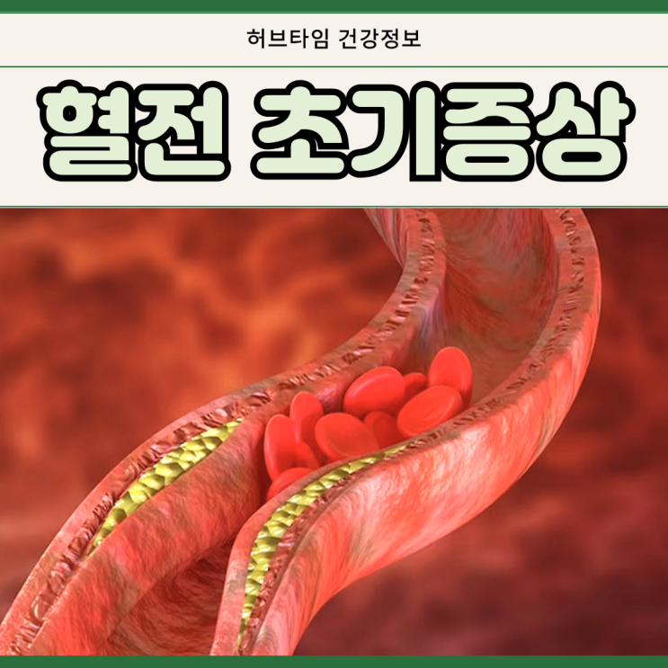 혈전 초기증상 다리 원인 뜻 : 네이버 블로그