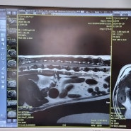 강아지 허리,목 디스크 MRI촬영+한방침치료