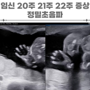 임신 20주 21주 22주 증상 정밀초음파