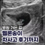 더운 여름 병원 가는 날이 기다려지는 요즘 ( 산부인과 멜론송이 피자 파스타 필라프 차사고 일상)