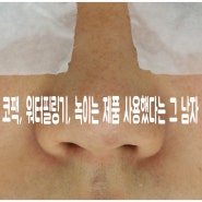 코팩, 워터필링기, 녹이는 제품 사용했다는 그 남자