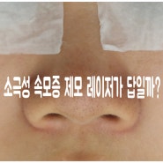 소극성 속모증 제모 레이저가 답일까?