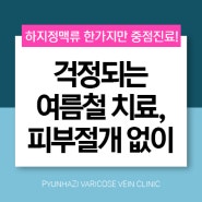 춘천하지정맥류 피부절개 없이 치료하는 곳