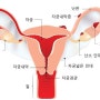 자궁내막증 임신 가능할까? 수술 경험부터 임신까지