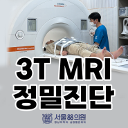 [수원 3T MRI 병원, 서울88의원] 뇌, 척추, 관절, 복부, 골반, 전립선 MRI 검사