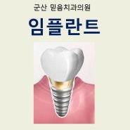 군산미장동치과-임플란트