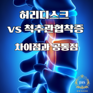 허리디스크 vs 척추관협착증: 차이점과 공통점