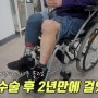 당뇨로 인한 다리절단 수술 후 2년 만에 걷게 된 사연 : 걸으니까 너무 좋아요