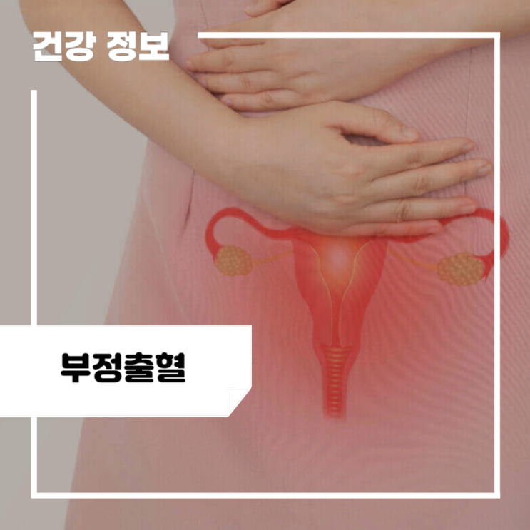 생리 부정출혈 원인 5가지, 부정출혈과 생리 차이 : 네이버 블로그