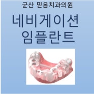 군산 미장동 치과 네비게이션 임플란트