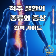 척추 질환의 종류와 증상: 완벽 가이드