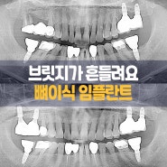 수원 시청역 치과 - 브릿지 치아가 흔들린다면 치료방법