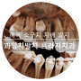 광교 수원 매복치발치 치과 - 매복 영구치 치배 교정치과 의뢰 발치 유치만기잔존 유치 영구치 치아 맹출 순서 치아 발생