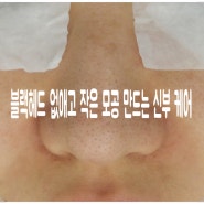 블랙헤드 없애고 작은 모공 만드는 신부 케어