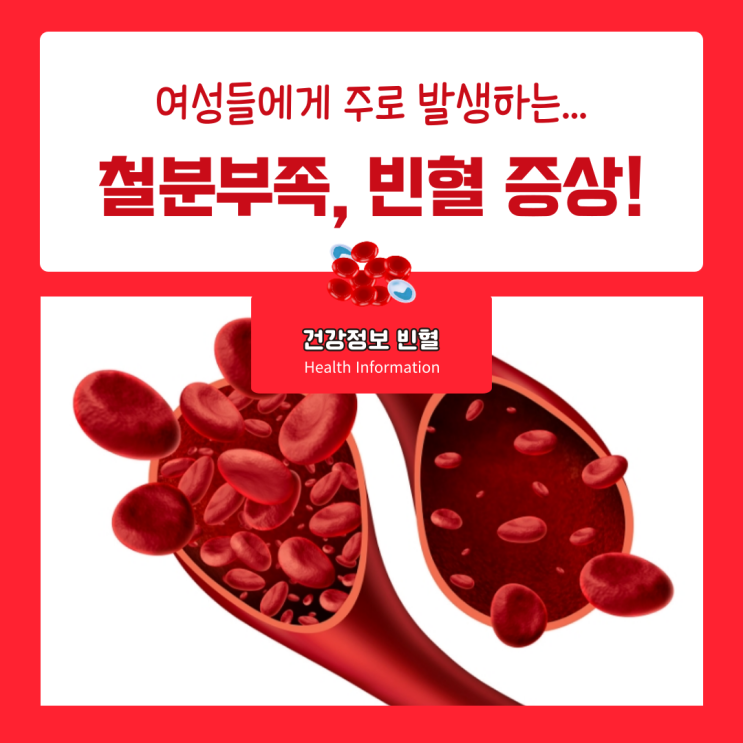 철분부족증상 빈혈 증상 특징과 빈혈에 좋은 음식 체크 : 네이버 블로그