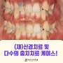 면목동 치과 (재)신경치료 및 다수의 충치치료 케이스, 숨어 있는 인접면 우식까지 꼼꼼하게!