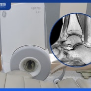 발목 인대 MRI 통해 인대파열 보다 세밀하게 체크