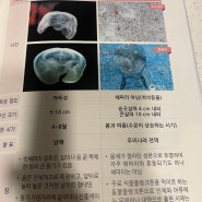한국 바다에 출몰하는 해파리 종류