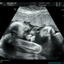 36주 낙태 브이로그를 바라보는 38주 출산맘의 생각