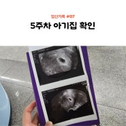 임신기록 #7 아기집 확인