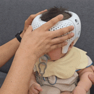 9개월 아기 단두증 교정헬멧 착용 시작