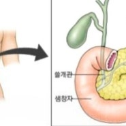 살려주세요 췌장!! 인슈린생산공장 #췌장을살리는길