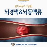 신경외과 | 알기쉬운 뇌질환! 뇌경색(허혈성 뇌졸중) & 뇌동맥류