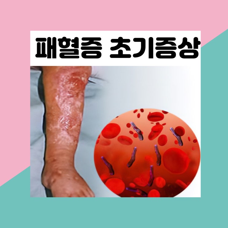 패혈증 뜻 초기 증상 원인 쇼크 사망률 치료 : 네이버 블로그