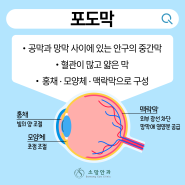 [약수역 소망안과] 결막염과 헷갈리기 쉬운 여름철 대표질환 포도막염! 포도막염 원인, 증상, 치료 알아보기