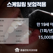 스케일링 주기, 비용