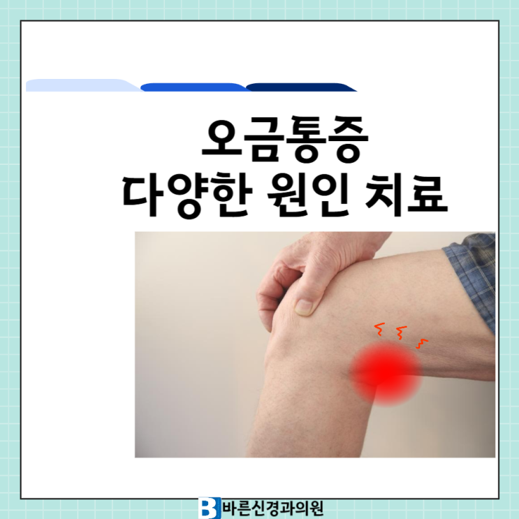 대전 오금통증★ 무릎 뒤 오금 통증 치료병원 : 네이버 블로그